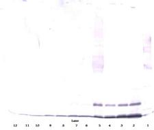 CCL13 / MCP4 Antibody - Anti-Human MCP-4 (CCL13) Western Blot Reduced