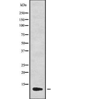 CCL13 / MCP4 Antibody - Western blot analysis of CCL13 using MCF-7 whole cells lysates