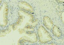 CCL13 / MCP4 Antibody - 1:100 staining mouse colon tissue by IHC-P. The sample was formaldehyde fixed and a heat mediated antigen retrieval step in citrate buffer was performed. The sample was then blocked and incubated with the antibody for 1.5 hours at 22°C. An HRP conjugated goat anti-rabbit antibody was used as the secondary.