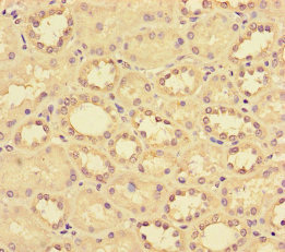CCL14 Antibody - Immunohistochemistry of paraffin-embedded human kidney tissue using CCL14 Antibody at dilution of 1:100