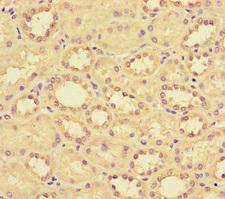 CCL14 Antibody - Immunohistochemistry of paraffin-embedded human kidney tissue using CCL14 Antibody at dilution of 1:100