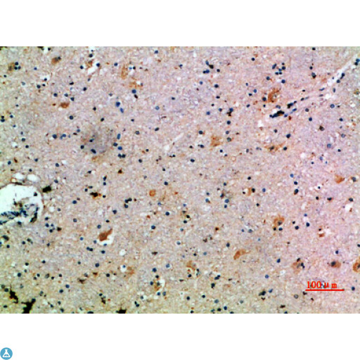 CCL14 Antibody - Immunohistochemical analysis of paraffin-embedded human-brain, antibody was diluted at 1:200.
