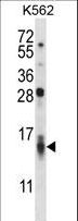 CCL15 / MIP5 Antibody - CCL15 Antibody western blot of K562 cell line lysates (35 ug/lane). The CCL15 antibody detected the CCL15 protein (arrow).