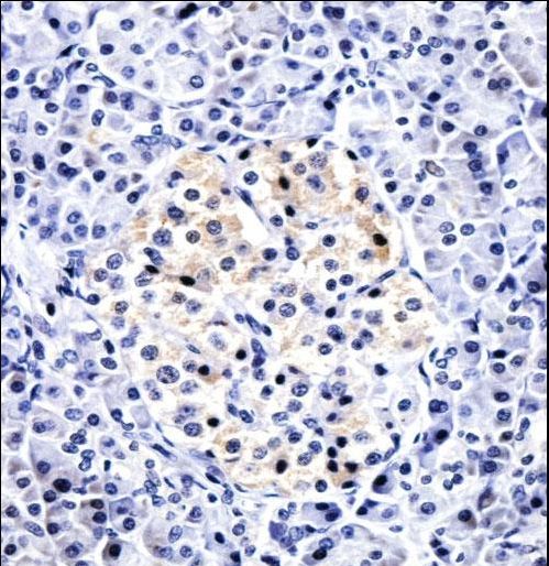 CCL15 / MIP5 Antibody - CCL15 Antibody immunohistochemistry of formalin-fixed and paraffin-embedded human pancreas tissue followed by peroxidase-conjugated secondary antibody and DAB staining.