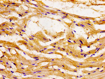 CCL15 / MIP5 Antibody - Immunohistochemistry image of paraffin-embedded human heart tissue at a dilution of 1:100