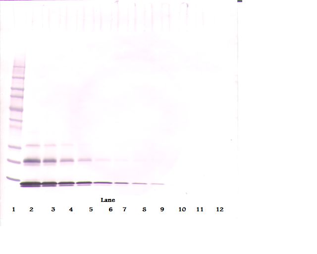 CCL16 / LEC Antibody - Western Blot (reducing) of CCL16 / LEC antibody