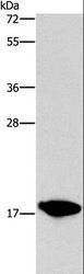 CCL16 / LEC Antibody - Western blot analysis of HepG2 cell, using CCL16 Polyclonal Antibody at dilution of 1:760.