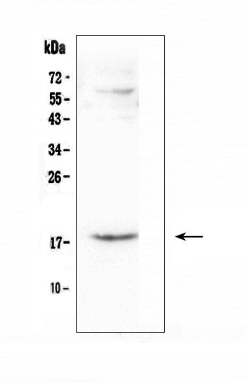 CCL16 / LEC Antibody - Western blot analysis of CCL16 using anti-CCL16 antibody. Electrophoresis was performed on a 5-20% SDS-PAGE gel at 70V (Stacking gel) / 90V (Resolving gel) for 2-3 hours. The sample well of each lane was loaded with 50ug of sample under reducing conditions. Lane 1: human A431 whole cell lysate. After Electrophoresis, proteins were transferred to a Nitrocellulose membrane at 150mA for 50-90 minutes. Blocked the membrane with 5% Non-fat Milk/ TBS for 1.5 hour at RT. The membrane was incubated with rabbit anti-CCL16 antigen affinity purified polyclonal antibody at 0.5 µg/mL overnight at 4°C, then washed with TBS-0.1% Tween 3 times with 5 minutes each and probed with a goat anti-rabbit IgG-HRP secondary antibody at a dilution of 1:10000 for 1.5 hour at RT. The signal is developed using an Enhanced Chemiluminescent detection (ECL) kit with Tanon 5200 system. A specific band was detected for CCL16 at approximately 18KD. The expected band size for CCL16 is at 14KD.