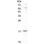 CCL16 / LEC Antibody - Western blot testing of human A431 lysate with LEC antibody at 0.5ug/ml. Predicted molecular weight ~14 kDa.