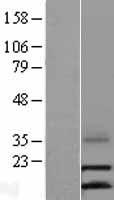 CCL16 / LEC Protein - Western validation with an anti-DDK antibody * L: Control HEK293 lysate R: Over-expression lysate