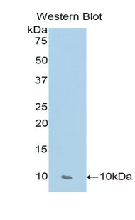 CCL17 / TARC Antibody - Western blot of recombinant CCL17 / TARC.  This image was taken for the unconjugated form of this product. Other forms have not been tested.