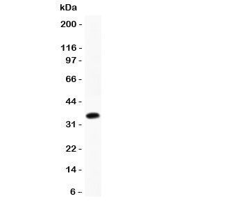 CCL17 / TARC Antibody - Western blot testing of CCL17 antibody and recombinant mouse protein (0.5ng)