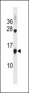 CCL17 / TARC Antibody - CCL17 Antibody western blot of NCI-H460 cell line lysates (35 ug/lane). The CCL17 antibody detected the CCL17 protein (arrow).