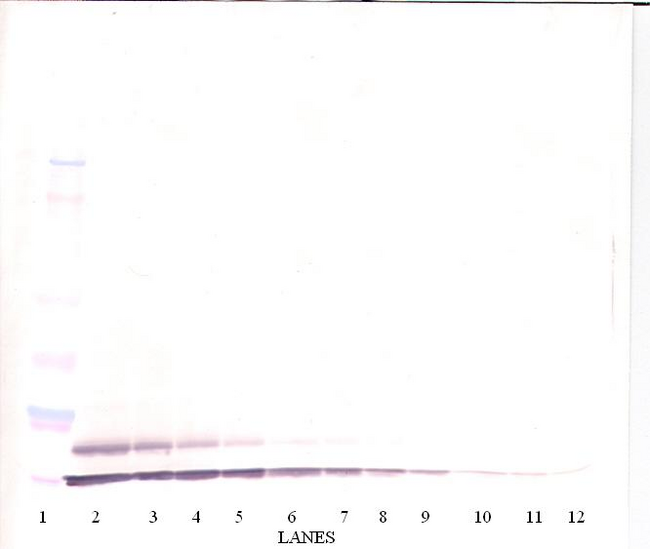 CCL17 / TARC Antibody - Anti-Human TARC (CCL17) Western Blot Unreduced