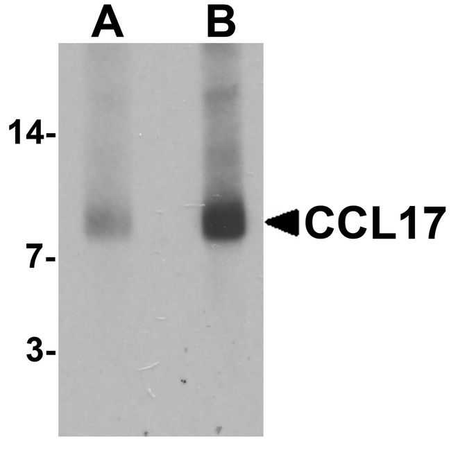 CCL17 / TARC Antibody - Western blot analysis of CCL17 in rat spleen tissue lysate with CCL17 antibody at (A) 1 and (B) 2 ug/ml
