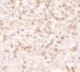 CCL17 / TARC Antibody - Immunohistochemistry of CCL17 in spleen tissue with CCL17 antibody at 5 ug/ml.