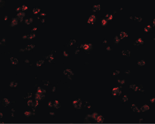 CCL17 / TARC Antibody - Immunofluorescence of CCL17 in human spleen tissue with CCL17 antibody at 20 ug/ml.