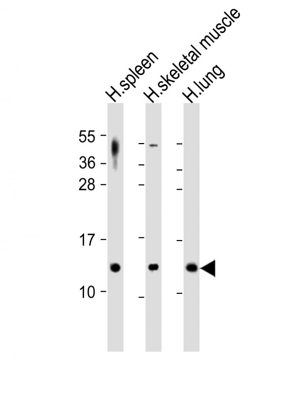 CCL17 / TARC Antibody - All lanes: Anti-CCL17 Antibody at 1:2000 dilution. Lane 1: human spleen lysates. Lane 2: human skeletal muscle lysates. Lane 3: human lung lysates Lysates/proteins at 20 ug per lane. Secondary Goat Anti-Rabbit IgG, (H+L), Peroxidase conjugated at 1:10000 dilution. Predicted band size: 11 kDa. Blocking/Dilution buffer: 5% NFDM/TBST.