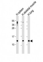 CCL17 / TARC Antibody - All lanes: Anti-CCL17 Antibody at 1:2000 dilution. Lane 1: human spleen lysates. Lane 2: human skeletal muscle lysates. Lane 3: human lung lysates Lysates/proteins at 20 ug per lane. Secondary Goat Anti-Rabbit IgG, (H+L), Peroxidase conjugated at 1:10000 dilution. Predicted band size: 11 kDa. Blocking/Dilution buffer: 5% NFDM/TBST.