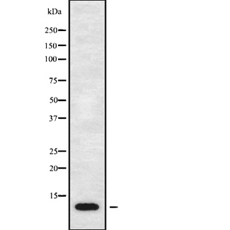 CCL17 / TARC Antibody - Western blot analysis of CCL17 using LOVO cells whole cells lysates