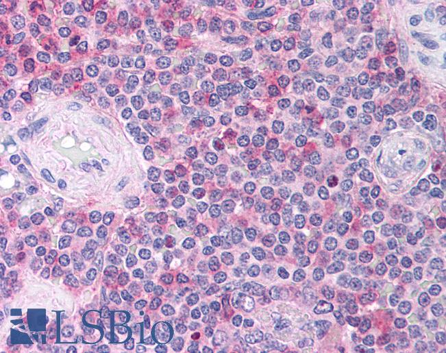 CCL18 / PARC Antibody - Anti-CCL18 antibody IHC of human spleen. Immunohistochemistry of formalin-fixed, paraffin-embedded tissue after heat-induced antigen retrieval. Antibody concentration 10 ug/ml.  This image was taken for the unconjugated form of this product. Other forms have not been tested.