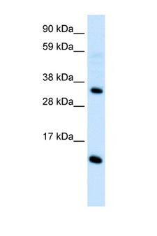 CCL18 / PARC Antibody - CCL18 antibody Western blot of Fetal Thymus lysate. Antibody concentration 1 ug/ml. This image was taken for the unconjugated form of this product. Other forms have not been tested.