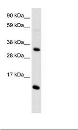 CCL18 / PARC Antibody - Fetal Thymus Lysate.  This image was taken for the unconjugated form of this product. Other forms have not been tested.