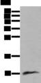 CCL18 / PARC Antibody - Western blot analysis of Human lung tissue lysate  using CCL18 Polyclonal Antibody at dilution of 1:400
