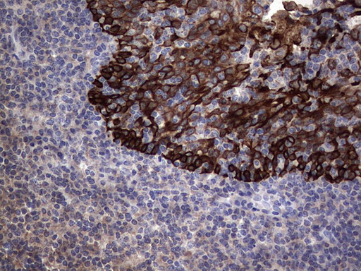 CCL19 / MIP3-Beta Antibody - Immunohistochemical staining of paraffin-embedded Human tonsil within the normal limits using anti-CCL19 mouse monoclonal antibody. (Heat-induced epitope retrieval by 1 mM EDTA in 10mM Tris, pH8.5, 120C for 3min,