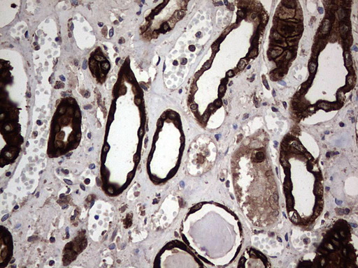 CCL19 / MIP3-Beta Antibody - Immunohistochemical staining of paraffin-embedded Human Kidney tissue within the normal limits using anti-CCL19 mouse monoclonal antibody. (Heat-induced epitope retrieval by 1 mM EDTA in 10mM Tris, pH8.5, 120C for 3min,