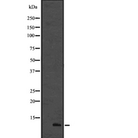 CCL19 / MIP3-Beta Antibody - Western blot analysis of CCL19 using 293 whole cells lysates
