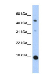CCL2 / MCP1 Antibody - CCL2 / MCP1 antibody Western blot of Transfected 293T cell lysate.