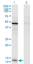 CCL2 / MCP1 Antibody - Western Blot analysis of CCL2 expression in transfected 293T cell line by CCL2 monoclonal antibody (M05), clone 1F10.Lane 1: CCL2 transfected lysate (Predicted MW: 11 KDa).Lane 2: Non-transfected lysate.