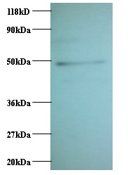 CCL2 / MCP1 Antibody - Western blot of C-C motif chemokine 2 Antibody at 2 ug/ml + EC109 whole cell lysate at 20 ug. Secondary: Goat polyclonal to Rabbit IgG at 1:15000 dilution. Predicted band size: 11 kDa. Observed band size: 50 kDa.  This image was taken for the unconjugated form of this product. Other forms have not been tested.