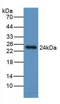 CCL2 / MCP1 Antibody - Western Blot; Samples: Human Spleen Tissue;