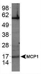 CCL2 / MCP1 Antibody - MCP1 Antibody - WB analysis of MCP1 in Hela whole cell lysates.  This image was taken for the unconjugated form of this product. Other forms have not been tested.