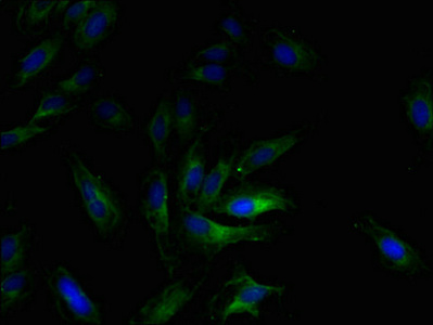 CCL2 / MCP1 Antibody - Immunofluorescent analysis of Hela cells using Ccl2 Antibody at dilution of 1:100 and Alexa Fluor 488-congugated AffiniPure Goat Anti-Rabbit IgG(H+L)