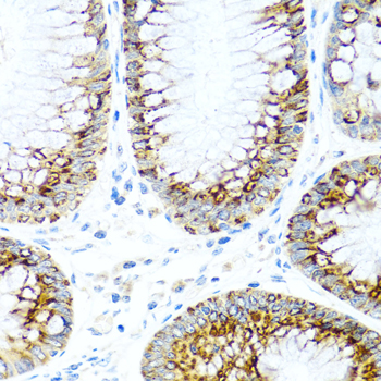CCL2 / MCP1 Antibody - Immunohistochemistry of paraffin-embedded human colon tissue.