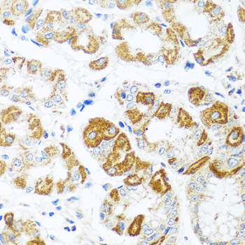 CCL2 / MCP1 Antibody - Immunohistochemistry of paraffin-embedded human stomach tissue.