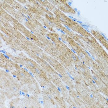 CCL2 / MCP1 Antibody - Immunohistochemistry of paraffin-embedded mouse heart.