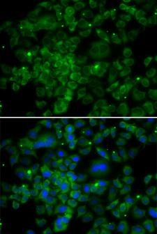 CCL2 / MCP1 Antibody - Immunofluorescence analysis of MCF7 cells.