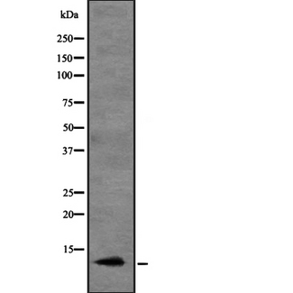 CCL20 / MIP-3-Alpha Antibody - Western blot analysis of CCL20 expression in HEK293 cells. The lane on the left is treated with the antigen-specific peptide.