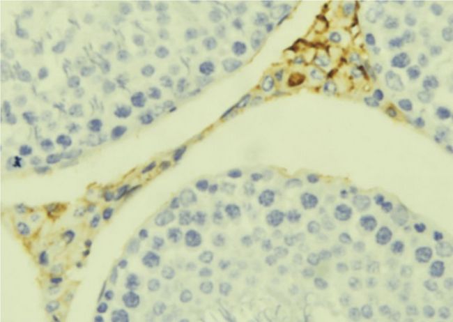 CCL20 / MIP-3-Alpha Antibody - 1:100 staining mouse testis tissue by IHC-P. The sample was formaldehyde fixed and a heat mediated antigen retrieval step in citrate buffer was performed. The sample was then blocked and incubated with the antibody for 1.5 hours at 22°C. An HRP conjugated goat anti-rabbit antibody was used as the secondary.