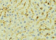 CCL21 / SLC Antibody - 1:100 staining mouse liver tissue by IHC-P. The sample was formaldehyde fixed and a heat mediated antigen retrieval step in citrate buffer was performed. The sample was then blocked and incubated with the antibody for 1.5 hours at 22°C. An HRP conjugated goat anti-rabbit antibody was used as the secondary.