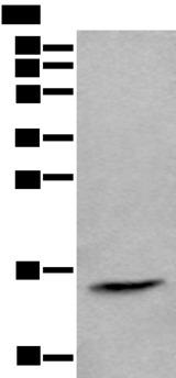 CCL21 / SLC Antibody - Western blot analysis of Human lymph gland tissue lysate  using CCL21 Polyclonal Antibody at dilution of 1:600