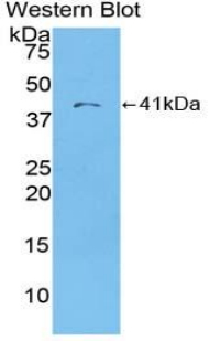 CCL22 / MDC Antibody - Western blot of recombinant MDC / CCL22.  This image was taken for the unconjugated form of this product. Other forms have not been tested.