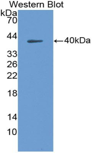 CCL22 / MDC Antibody - Western blot of recombinant MDC / CCL22.