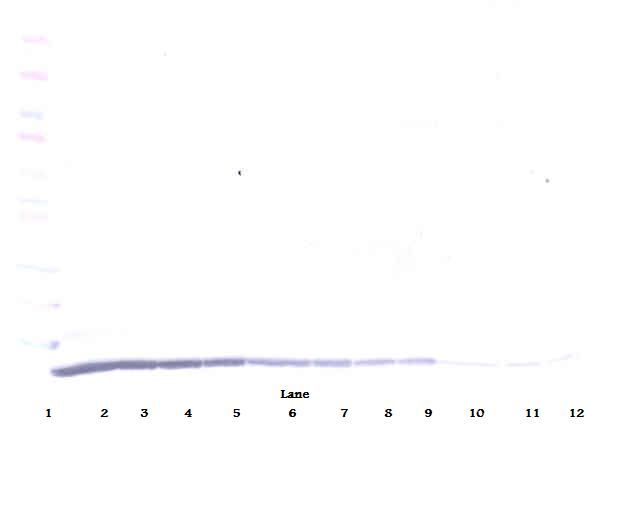 CCL22 / MDC Antibody - Western Blot (reducing) of MDC / CCL22 antibody. This image was taken for the unconjugated form of this product. Other forms have not been tested.