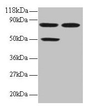 CCL22 / MDC Antibody - Western blot All lanes: C-C motif chemokine 22 antibody at 2µg/ml Lane 1: 293T whole cell lysate Lane 2: EC109 whole cell lysate Secondary Goat polyclonal to rabbit IgG at 1/15000 dilution Predicted band size: 10 kDa Observed band size: 50 kDa