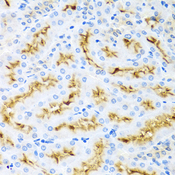 CCL22 / MDC Antibody - Immunohistochemistry of paraffin-embedded rat kidney tissue.